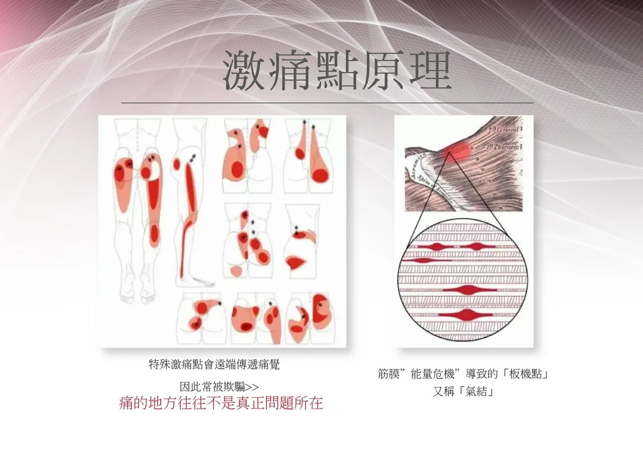 骨骼與關節長期受力示意插圖，說明姿勢與關節負擔關係的肩頸衛教圖